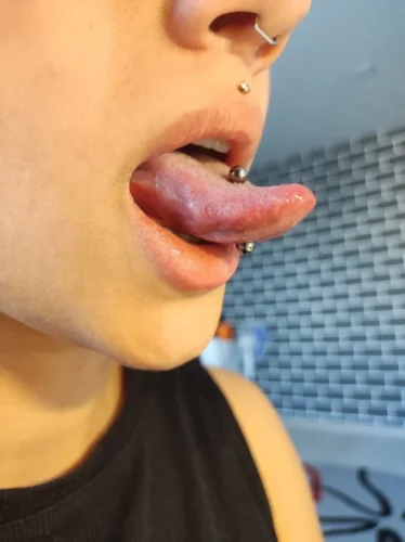 CuteBite™ Tongue Piercing Kit photo review