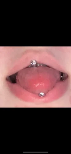 CuteBite™ Tongue Piercing Kit photo review